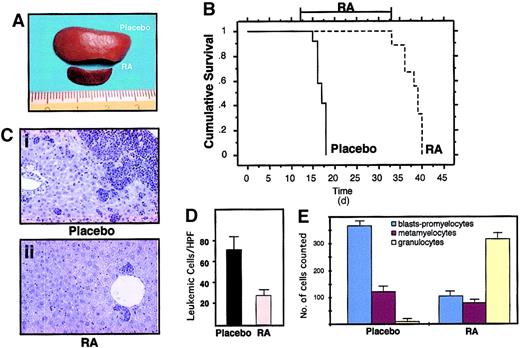Fig. 5. RA treatment induces differentiation of leukemic cells and prolongs survival of leukemic mice. / (A) Macroscopic appearance of spleens from 2 mice treated in the same experimental cohort with placebo (upper) or RA for 7 days (lower). (B) Survival curves of mice inoculated with spleen cells from one leukemic mouse (L3). RA treatment was started at day 12 after inoculation, when secondary leukemias were apparent in recipient mice (from analysis of peripheral blood smears). The RA pellet subcutaneously implanted has a duration of approximately 3 weeks. (C) Histologic analysis of leukemic infiltrates in the liver of one leukemic mouse (Ci), and of one leukemic mouse after 7 days of RA treatment (Cii). Original magnification × 400. (D) Extent of leukemic infiltration within the liver of mice treated with placebo (n = 4) or RA (n = 4). For each mouse examined the leukemic cells infiltrating the liver were counted in 40 high-power fields (HPFs; magnification × 630); for each animal the mean number of leukemic cells per HPF was calculated. The columns represent the mean of the values. (E) Differential cell counts in the bone marrow of mice treated with placebo (n = 4) or RA (n = 4). For each examined mouse, 500 myeloid cells were classified according to morphologic features.