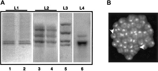 Fig. 6. APL is a monoclonal or oligoclonal disease. / Genomic DNA was prepared from leukemic mice (L1-L4, lanes 1, 3, 5, and 6) or from mice with secondary leukemias derived from reinjection of spleen cells from L1-L2 mice (lanes 2, 4). Samples were digested withHindIII, and then analyzed by Southern blot assay using the PML-RAR cDNA as a probe. (B) FISH analysis (using the proviral sequence as a probe) of metaphase-enriched nuclei of cells derived from the case “L1.” Arrowheads highlight the hybridization signals. Original magnification × 630.
