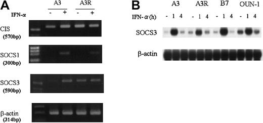 Fig. 3. Expression of SOCS family genes in CML cell lines. / (A) KT-1/A3 and A3R cells were cultured and stimulated for 1 hour with or without 1000 U/mL IFN-α. Total RNA was prepared and subjected to RT-PCR analysis using specific primers. (B) Total RNA was prepared from cells treated with 1000 U IFN-α for 1 to 4 hours and analyzed by Northern blotting for expression of SOCS3 gene.