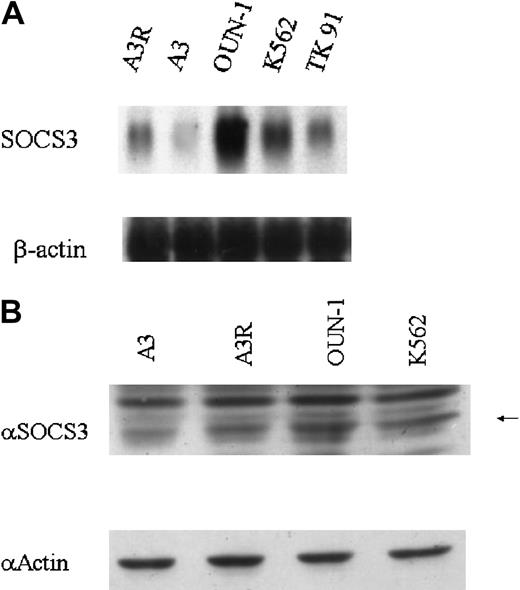 Fig. 4. Expression of SOCS3 mRNA and protein in CML cell lines. / (A) Total RNA was prepared from cells and analyzed by Northern blotting for expression of SOCS3 mRNA. (B) Cell extracts were prepared and immunoblotted with anti-SOCS3 and antiactin antibody. Arrow indicates 27-kDa SOCS3 protein.