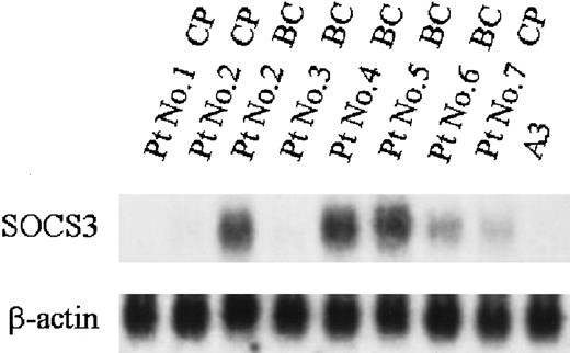 Fig. 8. Expression of SOCS3 mRNA in fresh CML cells. / Total RNA was isolated from BMMCs of CML patients and expression of SOCS3 was analyzed by Northern blotting.