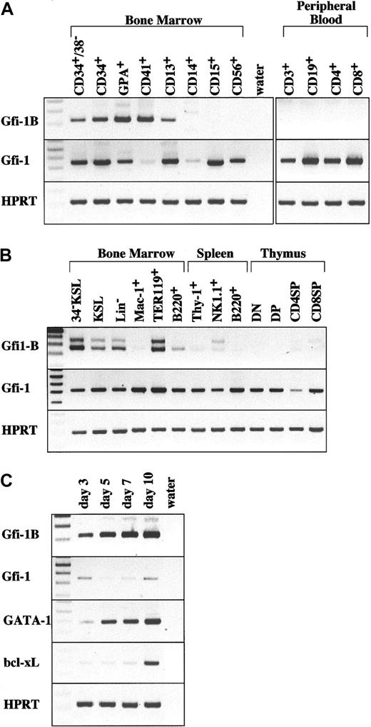 Fig. 1. Restricted expression of Gfi-1B in hematopoietic cells detected by RT-PCR. / (A) Expression of human Gfi-1B. Cells analyzed are bone marrow CD34+CD38− stem cells, CD34+ progenitor cells, glycophorin A (GPA)+erythroblasts, CD41+ megakaryocytes, CD13+myeloid progenitors, CD14+ macrophage, CD15+granulocytes, CD56+ NK cells, and peripheral blood CD3 T+ cells, CD19+ B cells, CD4+ T cells, and CD8+ T cells. (B) Expression of murineGfi-1B. Cells analyzed are bone marrow CD34−c-Kit+Sca-1+ lineage marker− stem cells (34–KSL), KSL progenitors, lineage marker− cells (Lin−), Mac-1+ myeloid cells, TER119+ erythroblasts, B220+ B cells, spleen Thy-1+ T cells, NK1.1+ natural killer (NK) cells, B220+ B cells, and thymic CD4−CD8− T cells (DN), CD4+CD8+ T cells (DP), CD4+CD8− T cells (CD4SP), and CD4−CD8+ (CD8SP). (C) Expression of human Gfi-1B during erythroid differentiation. Human peripheral blood CD34+ cells mobilized by G-CSF were collected and cultured under conditions that preferentially drive erythroid differentiation (details in “Materials and methods”). After incubation for the number of indicated days, cells were collected and subjected to RT-PCR analysis. The percentages of GPA+cells, BFU-Es, and CFU-Es in cells on the indicated days are as follows: day 3 (18.1%, 17.2%, 10.8%), day 5 (51.4%, 5.5%, 37.6%), day 7 (80.4%, 0%, 24.8%), and day 10 (91.6%, 0%, 2.1%). “Water” represents the negative control without template. RT-PCR was performed on normalized cDNA templates. PCR products were electrophoresed on agarose gels and visualized by ethidium bromide staining.