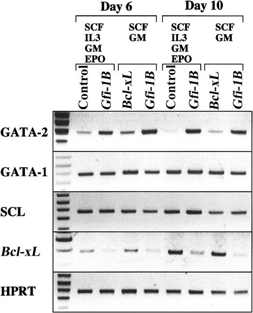 Fig. 7. Effect of Gfi-1B on the expression of genes involved in erythropoiesis. / CD34+ cells were transduced with either Bcl-xLor Gfi-1B and were cultured in the presence of SCF and GM-CSF. In addition, CD34+ cells transduced with either empty vector (control) or Gfi-1B were cultured in the presence of SCF, IL-3, GM-CSF, and EPO. With exogenousBcl-xL, a small but significant number of erythroblasts developed even in the absence of EPO (data not shown). On day 10 of culture, glycophorin A+ erythroblasts were purified by cell sorting, then subjected to RT-PCR analysis. RT-PCR was performed on normalized cDNA templates. PCR products were electrophoresed on agarose gels and visualized by ethidium bromide staining.