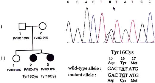 Fig. 1. Identification of the Tyr16Cys mutation in the twins. / The family pedigree is presented on the left side with the corresponding plasma FVIII activity for each member. Sequence chromatogram from twin II.1 is shown on the right side with the relevant wild-type and mutant partial sequences of the F8gene noted under the chromatogram. The arrow points to the double peaks of A and G at the second nucleotide position of codon 16, demonstrating a nucleotide transition in the heterozygous state.