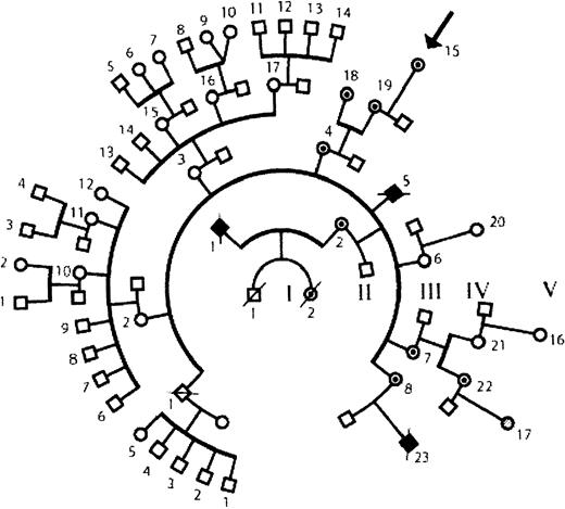 Fig. 1. Family tree. / The pedigree shows 5 generations. The patient under study, V-15, is indicated by an arrow. One documented case of WAS is the patient's maternal cousin (IV-23) who had an intron 6 splice site mutation, (IVS6 −1G>A). Two other relatives died in infancy of suspected WAS (II-1 and III-5). There are 6 known carrier females (III-4, III-7, III-8, IV-18, IV-19, and IV-22) in addition to the patient under study. The genotype is not defined for V-17. Symbols used are male (box), female (circle), deceased (slash), affected male (filled), female carrier (dotted fill), and unaffected subject (open symbol).
