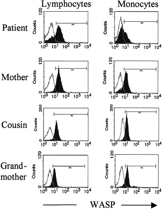 Fig. 5. Flow cytometry reveals 2 populations of lymphocytes and monocytes in the female patient. / PBMCs were stained intracellularly with WASP mAb 5A5. Lymphocytes and monocytes were gated on forward and side scatter. Note the presence of 2 populations, WASPbright and WASPdim, for both lymphocytes and monocytes of the patient. Lymphocytes of her mother are all WASPbright; the mother's monocytes are primarily WASPbright with a small WASPdim population. For the patient's cousin (IV-22) and grandmother (III-4), who are both carriers, all lymphocytes and monocytes were WASPbright. Open histograms indicate isotype control; closed histograms, WASP staining.
