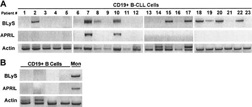 Fig. 3. Expression of BLyS and APRIL mRNA in CLL B cells. / Expression of BLyS and APRIL mRNA was analyzed by RT-PCR in 23 CD19+ B-CLL (A) or in CD19+ normal B cells and monocyte-enriched PBMCs (B).
