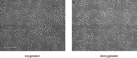 Fig. 5. Morphological sickling. / Photomicrographs of fixed SSRBCs after approximately 80 minutes of oxy/deoxy cycling. (A) Immediately after the oxygenator (pO2 = 106.8 mm Hg). (B) After the deoxygenator (pO2 = 40.0 mm Hg). The bars in panels A and B represent 100 microns.