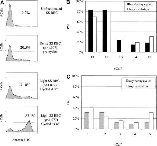 Fig. 9. Increased PS externalization of low-density cells in the presence of calcium. / (A) PS externalization (binding of annexin V–FITC) was measured by flow cytometry in unfractionated, dense, and rehydrated SSRBCs. (B) (C) PS externalization was determined in all density fractions after oxy/deoxy cycling or oxy (37°C) incubation in the presence (panel B) and absence (panel C) of calcium. Generated light cells (F1 and F2) had a higher percentage of PS+ cells than the original F5 cells. The presence of Ca++ greatly enhanced PS externalization in both the oxy incubated and cycled samples.