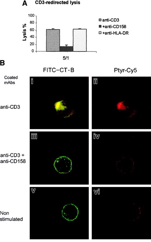 Fig. 2. KIR triggering prevents CD3-redirected lysis and CD3-induced membrane raft reorganization. / (A) Cytotoxic activity of 4D4 clone was assessed against anti-CD3–coated P815 murine cells. CTL 4D4 was added at a ratio of 5:1 to target in absence (anti-CD3) or in presence of 10 μg/mL of anti-CD158a (+ anti-CD158) or anti–HLA-DR mAbs (+ anti–HLA-DR). (B) Membrane reorganization of CTL clone 4D4 was analyzed by confocal microscopy after stimulation for 15 minutes at 37°C with mAb-coated beads. CTL membrane was labeled with fluorescent B subunit of Cholera Toxin (FITC–CT-B, green), and after cell permeabilization CTLs were labeled with anti-Ptyr mAb revealed by Cy5-labeled goat antimouse IgG (red). An overlay compacted image of serial optical sections is shown on left side panels (i,iii,v), the green color has been removed on right panel (ii,iv,vi; original magnification × 63).