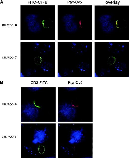 Fig. 3. KIR engagement prevents lipid raft polarization and signaling protein phosphorylation. / Confocal analysis of serial optical sections collected at 0.3-μm intervals. (A) 4D4 CTL clone labeled by FITC–CT-B (green) was stimulated with PKH26-labeled tumor cells (blue). 4D4 CTL clone was conjugated either with RCC-6 (upper panels) or RCC-7 (lower panels) and incubated 5 minutes at 37°C. After fixation, cells were stained with anti-Ptyr mAb (red). This picture represents an overlay and the side-side picture of the overlay showing labeling lipid rafts (FITC–CT-B) or tyrosine-phosphorylated proteins (Ptyr-Cy5) as indicated. (B) Stimulated 4D4 CTL clone was stimulated as in (A) and then stained with anti-CD3 mAb (green) and anti-Ptyr mAb (red). Original magnification × 63.
