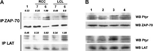 Fig. 4. Inhibitory effect of KIR on TCR-mediated ZAP-70 and LAT tyrosine phosphorylation. / (A) Postnuclear lysates of nonstimulated CTLs (lane 1) or stimulated by LCLs or RCC targets were immunoprecipitated with polyclonal anti–ZAP-70 (top panel) or anti–LAT antibody (bottom panel) and analyzed for tyrosine phosphorylation (left panels). Densitometric values are indicated in italics. (B) Same conditions of immunoprecipitation as in (A) of CTLs (lane 1) stimulated by RCC-7 (lane 2), masking of KIR ligand with anti–HLA-B/C (lane 3), or control anti–HLA-DR mAbs (lane 4) before stimulation. Bottom panels (WB ZAP-70 and WB LAT) show membrane reprobing with corresponding antibodies specific for precipitated proteins.