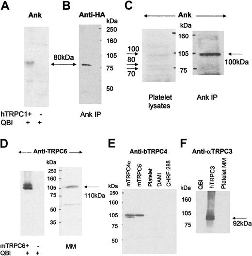 Fig. 1. Characterization of the TRPC1 antibody Ank and expression of TRPC proteins in human platelets. / (A) A 50 μg microsomal preparation of nontransfected and hTRPC1-transfected QBI-293A cells (QBI) was probed for Western blot detection with Ank antibody (5 μg/mL). (B) QBI-293A cells overexpressing hTRPC1 were lysed, immunoprecipitated (IP) with Ank, and probed with anti-HA (0.5 μg/mL). (C) Lysates of resting platelets were probed with Ank (left panel) or immunoprecipitated with Ank and probed with the Ank antibody (right panel). (D) 50 μg nontransfected and mTRPC6-transfected QBI-293A cells (left panel) and 50 μg platelet mixed membranes (right panel) were probed with anti-TRPC6 (1/400). (E) 50 μg mTRPC4α and mTRPC5-transfected QBI-293A cells and 100 μg mixed membranes from platelets and the megakaryocytic cell lines DAMI and CHRF-288 were probed with anti-bTRPC4 (1/200). (F) 50 μg nontransfected and hTRPC3-transfected QBI-293A cells and 50 μg platelet mixed membranes were probed with anti-αTRPC3 (1/2000). Molecular size markers are noted in kilodaltons (kDa) and TRPC protein sizes indicated with arrows. All Western blots are representative of at least 3 distinct determinations.