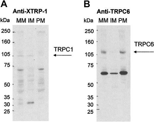 Fig. 2. Localization of TRPC1 and TRPC6 in highly purified platelet membranes. / Shown are Western blot analyses of platelet mixed membranes (MM) prior to high-voltage free flow electrophoresis (FFE) and purified plasma (PM) and intracellular membranes (IM) prepared using FFE. (A) 100 μg protein was probed with anti–XTRP-1 (1 μg/mL) and (B) 50 μg protein was probed with anti-TRPC6 (1/400). Molecular size markers are noted in kilodaltons (kDa) and the TRPC protein indicated with arrows.