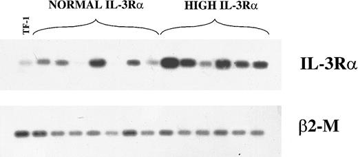Fig. 2. RT-PCR analysis of IL-3Rα and β2-M mRNA. / Analysis in 13 AML patients (7 in the group with normal IL-3Rα levels and 6 in the group with high IL-3Rα levels) and in TF-1 control cells.
