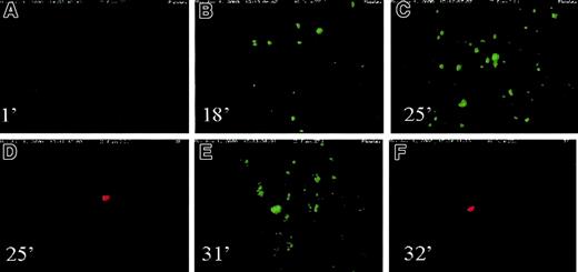 Fig. 2. Platelets and cTF on cover slides. / A series of images of platelets (green) and cTF (red) deposited onto the cover slides at various time points of flow. Wall shear rate used in this experiment was 100 s−1. Time sequence of images: (A) 1 minute; (B) 18 minutes; (C) 25 minutes; (D) 25 minutes; (E) 31 minutes; (F) 32 minutes. The direction of blood flow is from top to bottom. Original magnification × 20.