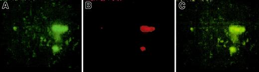 Fig. 3. Colocalization of platelet aggregates and deposited cTF. / Thrombi demonstrate colocalization of platelet aggregates (green) and deposited cTF (red). Panel A shows adhered platelet aggregates; cTF is shown in panel B, and panel C represents the superpositioning of panels A and B. The direction of blood flow is from top to bottom. Original magnification × 20.