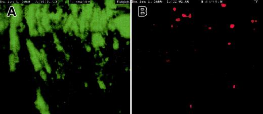 Fig. 4. Platelet aggregates downstream. / A large number of platelet aggregates (green) were imaged downstream, near the exit outlet of the chamber. cTF (red) was found anchored to such large aggregates. The direction of blood flow is from top to bottom. Original magnification × 20.