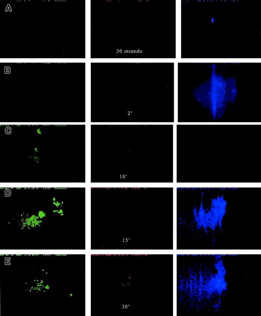 Fig. 5. Platelet, cTF, and fibrin movement. / Platelet (green) and fibrin (blue) movement across collagen-coated glass slides at 650 s−1 wall shear rate. Time sequence of images: (A) 30 seconds; (B) 2 minutes; (C) 10 minutes; (D) 15 minutes; (E) 20 minutes. Adhesion of platelets (green) as well as fibrin (blue) strands occurred within about 15 minutes of blood flow. The first cTF (red) signal was obtained after 20 minutes of flow. The direction of blood flow is from top to bottom. Original magnification × 20.