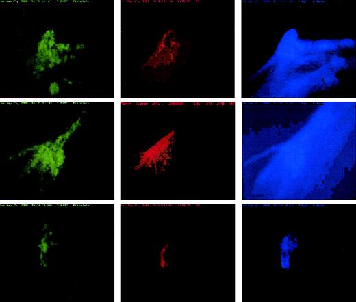 Fig. 6. Platelet, cTF, and fibrin incorporation into thrombi. / Incorporation of platelets (green), cTF (red), and fibrin (blue) into growing ex vivo thrombi obtained by perfusing whole, labeled blood at 650 s−1 wall shear rate. The deposition pattern of each of these components, although colocalized, is unique within the thrombi. The direction of blood flow is from top to bottom. Original magnification × 20.