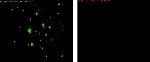 Fig. 7. Platelet adherence to noncoated slides. / Scanty platelet (green) adherence to non–collagen-coated glass slides at 650 s−1 wall shear rate is seen. Deposition of cTF (right panel) to the same substrate as well as any colocalization with adherent platelets could not observed. The direction of blood flow is from top to bottom. Original magnification × 20.