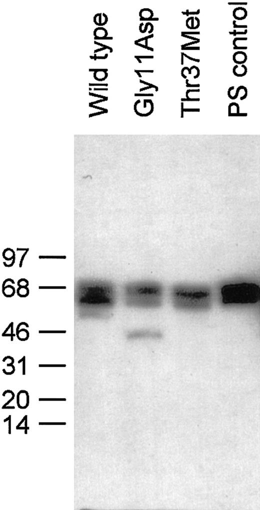 Fig. 3. Western blotting of wild-type protein S and variants expressed in HEK293 cells. / SDS-PAGE of 30 ng protein S under reducing conditions and immunoblotting with a polyclonal protein S antibody were performed as described in the text. The positions to which protein size markers migrated are indicated to the left, along with their molecular weight in kDa.