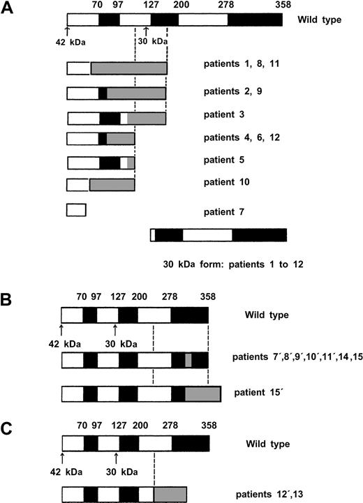 Fig. 2. Diagrammatic representation of proteins encoded by wild-type and mutant. / CEBPA alleles. White and black boxes represent wild-type CEBPA sequence and gray boxes a shift of the reading frame encoding a novel peptide until formation of stop codon. The black boxes shows functional domains (TAD1, TAD2, bZIP), and the arrows show the 2 ATG initiation codon. (A) Proteins encoded by the 12 N-terminal mutants. (B) Proteins encoded by the 8 C-terminal mutants. Notably, mutation in patient 8′ affected only the 30-kDa form because of the presence of a N-terminal mutation (patient 8, panel A) on the same allele inducing an alteration of the 42-kDa protein. (C) Proteins encoded by the 2 middle large deletion mutants.