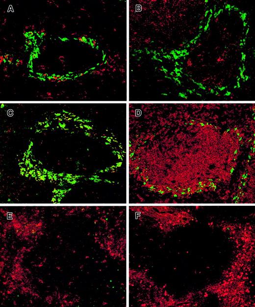 Fig. 4. mSIGNR1 is specifically expressed by splenic MZMs. / (A-D) Immunofluorescence double staining of murine spleen tissue sections with the polyclonal antibody against mSIGNR1 698 (green) and in red CD11c (A), DEC-205 (B), ER-TR9 (C), B220 (D). Original magnification × 200). (E,F) Immunofluorescence of double staining of murine spleen tissue sections after depletion with dichloromethylene diphosphonate liposomes. Double staining with (E) CD11c (red) and ER-TR9 (green); and (F) CD11b (red) and polyclonal mSIGNR1 antibody 698 (green). Original magnification × 200.