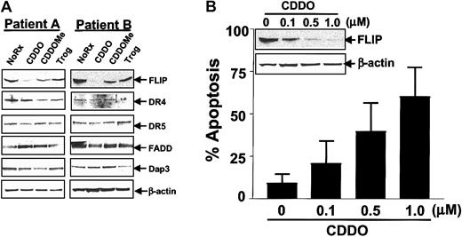 Fig. 7. CDDO down-regulation of the antiapoptotic protein FLIP in CLL. / CLL B cells were cultured for 24 hours in the presence or absence of 1 μM CDDO, 0.5 μM CDDO-Me, or 10 μM troglitazone. CLL B cells were recovered from cultures, and the percentage of apoptosis was determined by annexin V–FITC/PI double staining with the use of flow cytometry analysis. Alternatively, protein-containing lysates were prepared, normalized for total protein content (12.5 μg per lane), and analyzed by SDS-PAGE/immunoblot assay with the use of antibodies specific for DR4, DR5, FADD, DAP3, FLIP, or β-actin. (A) Two representative patient samples are shown of a total of 12 analyzed. (B) A dose response is shown for CDDO at 0.1 to 1.0 μM (means ± SD; n = 3).