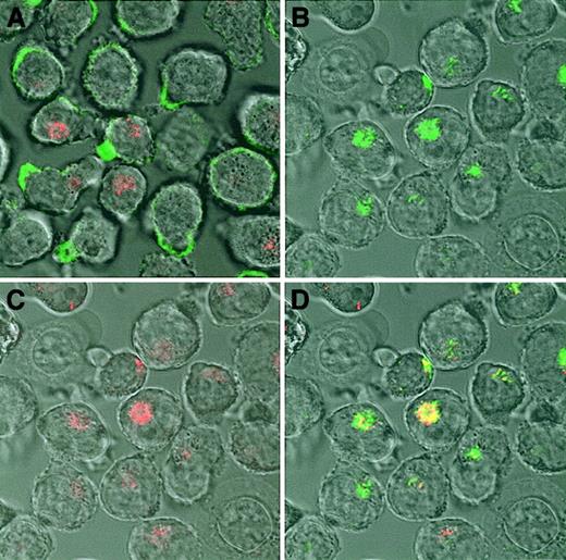 Fig. 4. Internalization of OPG in CAG cells. / (A) CAG cells incubated on ice for 30 minutes with Alexa Fluor 488–conjugated human OPG (green) shows cell surface binding of OPG. (B-D) Subsequently, the cells were incubated for 1 hour at 37°C, washed, and examined by confocal microscopy. The results show that OPG is internalized, colocalizing (yellow) with the lysosomal marker LysoTracker Red DND-99 (red). Original magnification × 630.