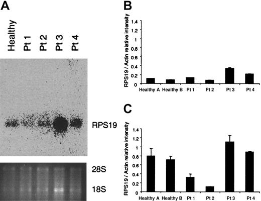 Fig. 2. RNA analysis in mononuclear and CD34+ cells from RPS19-deficient patients. / (A) RNA was isolated from mononuclear cells of a healthy individual and 4 patients (Patients 1-4, Table 1) with RPS19 mutations and examined by northern blot analysis using a full-length RPS19 probe. No abnormal transcripts were detected. (B, C) RNA from mononuclear cells (B) and CD34+ cells (C) was analyzed by quantitative RT-PCR using a LightCycler to amplify RPS19 and actin transcripts. The figures show the signal intensity ratio between the RPS19 and actin transcripts. The Q-RT-PCR experiments in B and C represent the average of 2 experiments.
