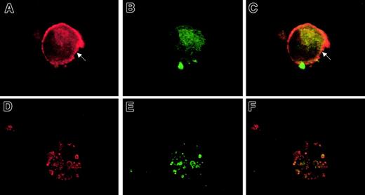 Fig. 7. Analysis of MHC class II (DR, DP, DQ) and HLA-DM protein localization in CMV latently infected cells. / Immunofluorescence staining of mock-infected (A-C) and CMV-infected cells (D-F) at day 15 after infection. Cells were dual stained for MHC class II (A and D; red staining) and HLA-DM (B and E; green staining). Fluorescent images were digitally overlaid to assess colocalization (C, F). Arrow indicates cell surface periphery MHC class II staining on a mock-infected cell. Original magnification, × 600.