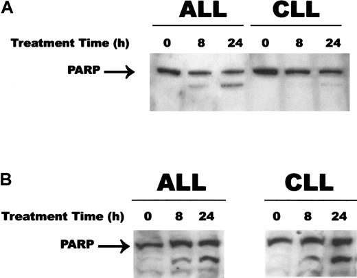 Fig. 5. PARP cleavage during CD437- and MM002-mediated apoptosis. / WSU-CLL and ALL-REH cells were seeded in 6-well plates as described in the legend to Figure 1. CD437 (panel A) or MM002 (panel B) (500 nM) or vehicle alone was added to the cells, and the cells were harvested at various times. Western blots were performed as described in “Materials and methods.”