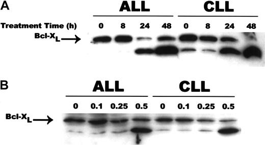 Fig. 6. CD437-mediated cleavage of Bcl-XL. / WSU-CLL and ALL-REH cells were exposed to 500 nM CD437 for 0, 8, 24, or 48 hours (panel A) or 0.1, 0.25, or 0.5 μM CD437 for 48 hours (panel B) as described in the Figure 4 legend. Cells were harvested 24 hours later, and Bcl-XL cleavage was assessed by means of Western blots. Actin was used as loading control.