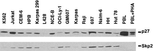 Fig. 1. Expression of Skp2 and p27Kip1 in PBLs and cell lines derived from hematopoietic neoplasms. / Quiescent PBLs express high levels of p27Kip1 that decrease upon activation with phytohemagglutinin (PHA). Levels of Skp2 protein expression show an inverse relationship to levels of p27Kip1 in 10 of 15 cell lines. Quiescent PBLs and their activated counterparts show the absence of Skp2 protein expression.
