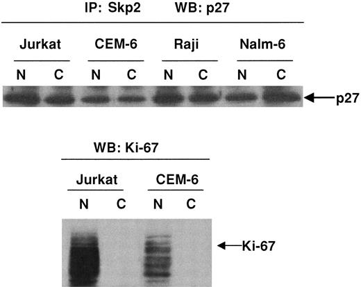 Fig. 4. Demonstration of p27Kip1/Skp2 complexes in nuclear and cytoplasmic fractions. / Immunoprecipitation studies demonstrate p27Kip1/Skp2 complexes within nuclear and cytoplasmic fractions. Subcellular fractions of Jurkat, CEM-6, Raji, and Nalm-6 cells were immunoprecipitated with polyclonal antibody to Skp2 followed by Western blot analysis with anti-p27Kip1. Subcellular fractions analyzed with antibody to Ki-67 show that expression of this protein was restricted to nuclear fractions. Western blot analysis for p27Kip1, however, demonstrates in vitro complexes of p27Kip1/Skp2 within both the cytoplasmic and the nuclear fractions.