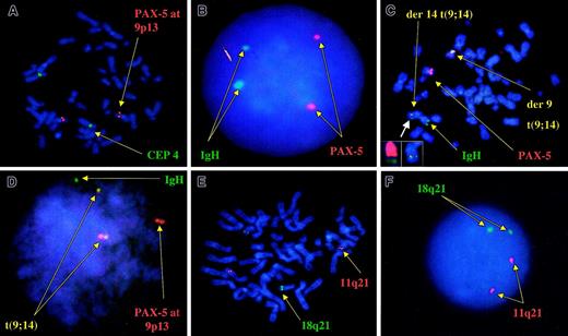Fig. 2. Correct localization of the probes used for the detection of t(9;14)(p13;q32) and t(11;18)(q21;q21). / (A) Localization of the PAX-5–specific probe to chromosome 9 at band p13 (red). The green signal is that of chromosome 4 centromeric probe. (B) Normal pattern of hybridization for the IgH/PAX-5 probes, consistent with 2 pairs of discrete green and red signals, respectively, without fusion signals. (C) Metaphase FISH assay in a patient with known t(9;14)(p13;q32) serving as the positive control. Metaphase shows 2 fusion signals indicating a balanced reciprocal translocation and the germ line configuration for the IgH probes (green) and the 9p13 PAX-5probe (red). Smaller boxes in the lower left corner depict an enlarged view of the der(14)t(9;14) chromosome, showing the fusion signal indicative of the translocation (right small box) and the same chromosome after stripping of the probes and hybridizing with whole chromosome paints (WCPs). Left small box: red indicates WCP 14, and green indicates WCP 9. (D) Interphase FISH results on the same patient, and 2 distinct fusion signals indicative of the balanced translocation. (E) Correct localization of the probes used for the detection of t(11;18)(q21;q21). (F) Normal interphase FISH pattern for these same 2 probes, again consistent with 2 pairs of discrete green and red signals, respectively, without resultant fusion signals.
