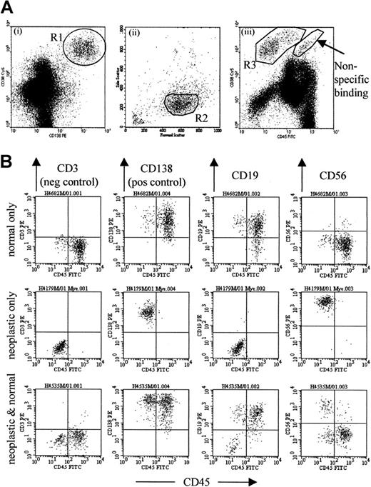 Fig. 1. Flow cytometric detection of neoplastic plasma cells. / (A) The gating strategy used to detect plasma cells, designed to exclude the majority of contaminating events (particularly B-progenitor cells, apoptotic cells, and cellular debris) common in posttreatment samples, described in detail in “Patients and methods.” (B) Representative plots from patients at 3 months after transplantation. The top row shows a patient whose bone marrow sample contains only normal phenotype (CD19+CD56dim) plasma cells. The middle row shows a sample with only neoplastic phenotype (CD19− or CD19+CD56+) plasma cells. The bottom row shows a sample containing mostly normal plasma cells with a detectable neoplastic population that represents 15% of total plasma cells.