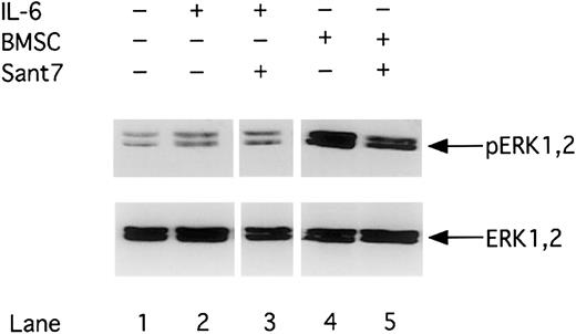 Fig. 4. Phosphorylation of MAPK/ERK1,2 is up-regulated in the presence of BMSCs. / INA-6 cells were cultivated without IL-6 (lane 1), with 2 ng/mL IL-6 (lanes 2 and 3), or with BMSCs (lanes 4 and 5) and treated with Sant7 (50 μg/mL; lanes 3 and 5) for 12 hours. Western blot analysis with a Thr202/Tyr204-phosphospecific anti-ERK1,2 antibody was performed to determine the phosphorylation status of ERK1,2 (pERK1,2) in INA-6 cells. Western blot analysis of the unphosphorylated ERK1,2 served as a loading control.