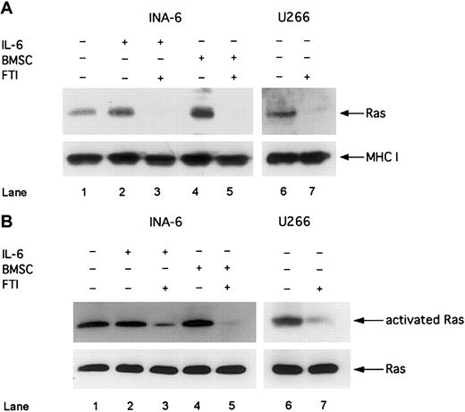 Fig. 5. FTI FPT III blocks Ras membrane translocation and Ras activation. / INA-6 cells were cultivated without IL-6 (lane 1), with 2 ng/mL IL-6 (lanes 2 and 3), or with BMSCs (lanes 4 and 5). U266 and INA-6 cells were treated with FTI FPT III (50 μM; lanes 3, 5, and 7) for 12 hours. (A) Western blot analysis of membrane fractions with an anti-Ras mAb was performed to analyze the effect of 50 μM FTI FPT III on membrane translocation of Ras. MHC class I served as a control for nonfarnesylated membrane proteins. (B) Activated Ras was precipitated with a Raf1-(RBD)-GST fusion protein and analyzed by using an anti-Ras antibody (Ras activation assay). Staining for Ras in whole cell lysates without precipitation served as a control. The IL-6–independent cell line U266 was cultivated without IL-6 or BMSCs (lanes 6 and 7).