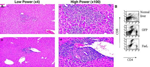 Fig. 6. Mice that received transplants of syngeneic FasL+ lin− BMs responded to an antigenic infectious challenge. / (A) Representative liver histologies of mice 4 days afterL monocytogenes injection. Some hepatic inflammation was seen in all mice in both control (top) and experimental (bottom) groups. (B) Livers were analyzed for T-cell infiltration by making single-cell suspensions from a portion of the liver and staining for T-cell markers. Shown are representative FACS plots of correlated CD4 and CD8 staining of the liver cells from a normal uninfected mouse liver, a liver from a mouse that received a transplant of control GFP+ lin− BMs, and a liver from a mouse that received a transplant of FasL+ lin−BMs.
