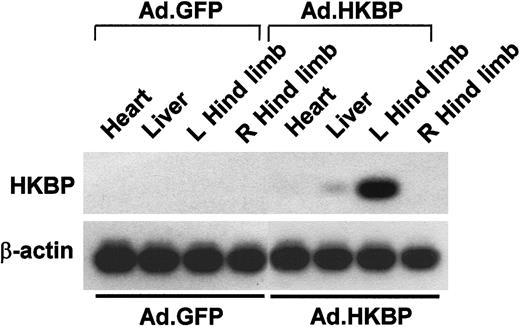 Fig. 3. RT-PCR and Southern blot analysis of human kallistatin mRNAs in tissues at day 5 after gene delivery. / Adenovirus Ad.HKBP or control virus Ad.GFP was locally injected into left hind limb after surgery. Right hind limb did not receive any surgery and virus injection. Amount of loading samples was normalized by using the β-actin housekeeping gene.