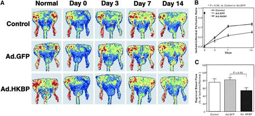 Fig. 4. Effects of kallistatin gene delivery on spontaneous angiogenesis in ischemic hind limbs. / (A) Representative laser Doppler images of hind-limb blood perfusion were measured before, right after, and at day 3, day 7, and day 14 after surgery. The perfusion signal is displayed as a different color. Dark blue means low perfusion or no perfusion, whereas red color means the highest perfusion. (B) Quantitative results of Doppler images were based on all of animals in 3 experimental groups. Each value represents mean ± SEM (n = 8). (C) Fluorescent microspheres assay was applied to determine the regional blood flow in hind limbs at 2 weeks after surgery. Each value represents mean ± SEM (n = 7).