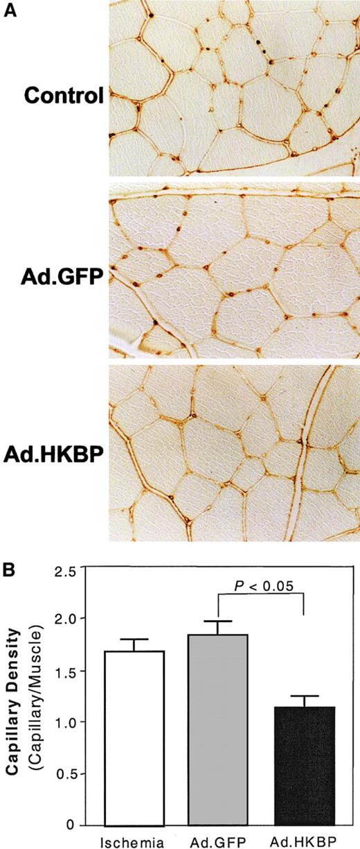 Fig. 5. Effect of kallistatin gene delivery on capillary formation in rat ischemic hind limbs. / Adductor muscles were collected at 2 weeks after gene delivery for histologic analysis. (A) Representative histologic sections were stained with antibody against rat CD31. (B) Quantitative analysis of CD31 immunostaining. Each value represents mean ± SEM (n = 4-9).
