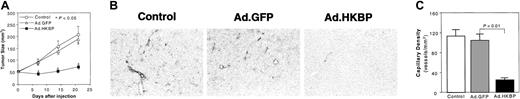 Fig. 6. Effects of kallistatin gene delivery on tumor growth. / (A) Kallistatin gene delivery inhibits tumor growth. MDA-MB-231 carcinoma cells were subcutaneously implanted into athymic mice. When the tumor had reached a volume of 50 mm3 (day 0), mice received an intratumoral injection of PBS (n = 16), 109pfu adenovirus carrying GFP cDNA (Ad.GFP, n = 17), or kallistatin cDNA (Ad.HKBP, n = 16). Each value represents mean ± SEM. (B) Kallistatin gene delivery inhibits tumor angiogenesis. Tumor tissues were collected at 3 weeks after gene delivery. Immunostaining with an anti–mouse CD31 monoclonal antibody demonstrated rarefication of small tumor blood vessels in kallistatin-treated tumors (Ad.HKBP) as compared with control tumors (Ad.GFP). (C) The number of CD31-stained blood vessels in 6 different microscopic fields from 3 different hot spots from each tumor section (8-11 tumors in each group) was evaluated. Each value represents mean ± SEM.