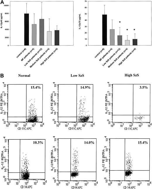 Fig. 2. PBMCs from SzS patients exhibit the significantly decreased ability to produce IL-12 p70, whereas production of IL-12 p40 is not significantly impaired. / (A) PBMCs from healthy donors, mycosis fungoides patients, and SzS patients with different levels of tumor burden were stimulated with SAC for 48 hours. Cytokines were measured in cell-free supernatants by radioimmunoassay. Data represent means (±SD) of tested patients. *P < .001 compared with healthy donors. (B) Blood from healthy donors and from patients with low and high tumor burden was stimulated with SAC for 5.5 hours and then stained, and lineage-negative cells were analyzed for coexpression of HLA-DR/CD11c and IL-12 p40/p70 or CD14 and IL-12 p40/p70. Right upper quadrant numbers represent the percentages of double-positive cells.