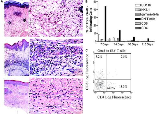Fig. 2. DN T cells infiltrate donor-specific skin allografts and form the dominant subset of graft-infiltrating T cells. / (A) A group of (2C × dm2)F1 mice were given DLI followed by transplantation of both (B6 × Balb/c)F1allogeneic and (B6 × dm2)F1 syngeneic skin grafts. At 21 days (top and middle panels) and 120 days (bottom panel) after transplantation, the accepted skin grafts were harvested and stained with hematoxylin and eosin. In each instance, an overview picture of the skin-graft site is shown in the left panel (× 50) and a close-up view of the deep dermis is shown in the right (× 400). The top panel shows a syngeneic graft at 21 days after transplantation. The epidermis and dermis are normal, and dermal appendages are present (left). In the deep dermis, there is no cellular infiltrate and blood vessels and collagen fibers are normal. The middle panel shows an allograft at 21 days after transplantation. The epidermis shows acanthosis, hyperkeratosis, and focal keratotic plugging. The dermis is edematous and there is a heavy cellular infiltrate in the middle and deep dermis (left). The infiltrate in the deep dermis is predominantly lymphocytic (right). The bottom panel shows an allograft at 120 days after transplantation. The skin structure is normal, except in the deep dermis, where there is a mild cellular infiltrate and fibrosis (left). The deep dermis shows an increase in collagen fibers and is less vascular than normal skin. The infiltrate cells are much less numerous than what was observed at 21 days and are predominantly lymphocytes. (B) Graft-infiltrating cells were collected from the accepted (B6 × BALB/c)F1 skin grafts 7, 14, 58, and 110 days after transplantation. The cells were analyzed by flow cytometry for CD11b+, NK1.1+, γδ-TCR+, CD8+, CD4+, and 1B2+DN T cells. Shown are representative proportions of positive graft-infiltrating cells from at least 3 mice. NT indicates not tested. (C) Graft-infiltrating cells were collected from the DLI-treated (B6 × BALB/c)F1 skin grafts of (2C × dm2)F1 mice 1 week after transplantation. The cells were analyzed by flow cytometry for expression of 1B2, CD4, and CD8. The histogram is gated on the 1B2+ T-cell population.