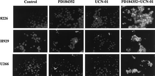 Fig. 1. UCN-01 and PD184352 interact synergistically to induce apoptosis in MM cells. / Logarithmically growing 8226, H929, and U266 MM cells were exposed to 10 μM PD184352 ± 150 nM UCN-01 for 24 hours, after which cytospin preparations were obtained and apoptosis assessed by TUNEL assay as described in “Materials and methods.” Slides were viewed under fluorescence microscopy under × 60 magnification. An additional experiment yielded equivalent results.