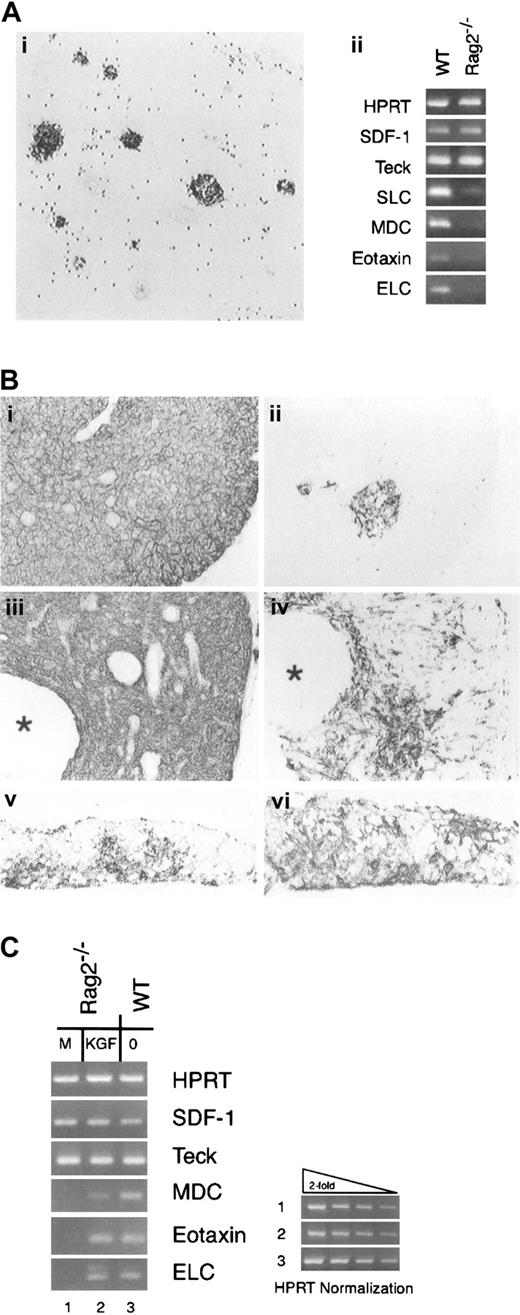 Fig. 5. KGF and the RAG2−/− thymic environment. / (A) The medullary compartment of the RAG2-deficient thymus. (i) The medullary compartment of RAG2-deficent mice defined by the 3G10 reactivity. Scattered dots represent endogenous peroxidase activity. Magnification × 35. (ii) Analysis of thymus chemokine expression. RNA samples from wild-type (WT) and RAG2−/− thymi were treated with DNAse and then subjected to RT-PCR using a panel of chemokine primers. (B) Thymus tissue from RAG2−/− mice receiving repeated intra-peritoneal administration of vehicle (i, ii) or KGF (iii, iv) were processed for immunohistochemistry. The distribution of all epithelial cells was detected by an antibody against E-cadherin (i, iii), and the distribution of medullary epithelium with 3G10 antibody (ii, iv). Asterisks indicate cystic structures in the KGF-treated RAG2−/− thymus. Intact day-16 FTOC from C57Bl/6 mice cultured for 7 days in the absence (v) or presence (vi) of KGF at 100 ng/mL and then stained with 3G10 to demonstrate the medullary TE compartment. Panels i-iv, magnification × 40; panels v, vi, × 50. (C) RT-PCR analysis of chemokine mRNA expression in RAG2−/− thymi treated with vehicle or vehicle containing KGF. Representative of 2 independent experiments with groups of 4 mice.