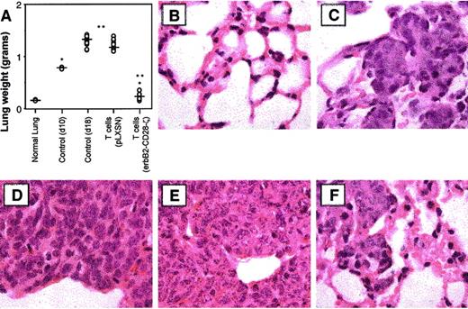 Fig. 7. Reduction of established lung tumor burden by T-scFv-anti-erbB2-CD28-ζ cells. / (A) Whole lung weight from groups of 10 scid mice, 18 days after intravenous injection of erbB2+ MDA-MB-435 breast carcinoma cells (5 × 106). Mice were injected intravenously with a single dose (107) of either BALB/c WT T-pLXSN cells or T-scFv-anti-erbB2-CD28-ζ cells on day 10 after tumor inoculation. Normal whole lung weight (g) (no tumor, normal lung, n = 2) or control (not receiving T-cell transfer) whole lung weight from tumor-inoculated mice at day 10 (n = 2) or day 18 (n = 10) were also recorded. Significant differences in lung weight were determined by Mann-Whitney test and denoted (*P < .01, **P < .001). (B-F) Histology of lung sections (original magnification × 100) by hematoxylin and eosin staining as follows: (B) untreated mice (normal lung); (C) control MDA-MB-435 tumor growth at day 10 (no T-cell transfer); (D) control MDA-MB-435 tumor growth at day 18 (no T-cell transfer); (E) day 18 with T-pLXSN cell transfer; and (F) day 18 with T-scFv-anti-erbB2-CD28-ζ cell transfer.